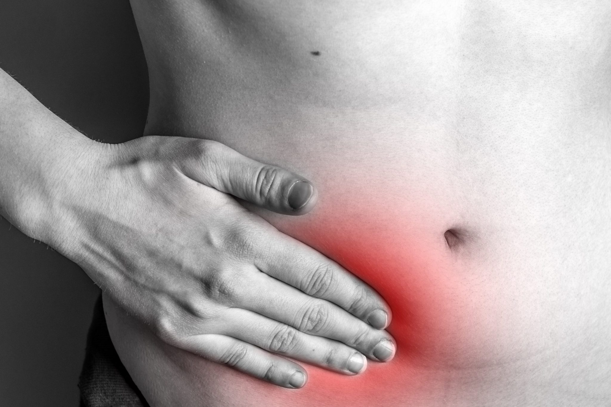 Hernias